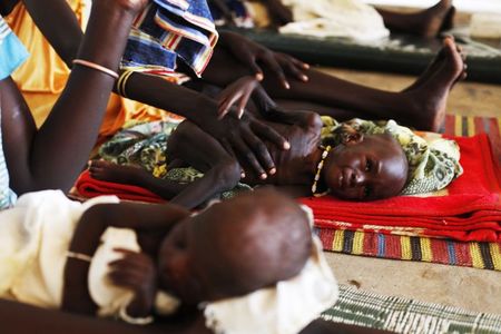 © Reuters. هزال الأطفال في جنوب السودان ينبىء بمجاعة تلوح في الأفق