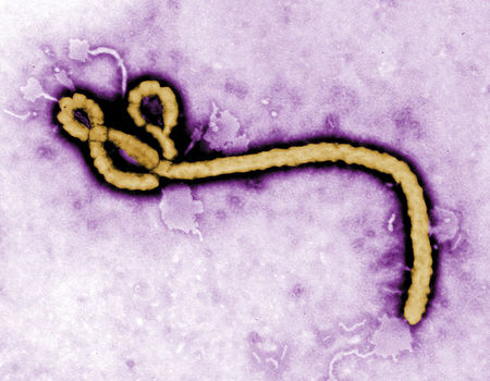 © Reuters. Unos análisis confirman que el sacerdote español Miguel Pajares tiene ébola