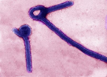 © Reuters. A transmission electron micrograph shows Ebola virus particles in this undated handout image released by the USAMRIID in Fredrick, Maryland