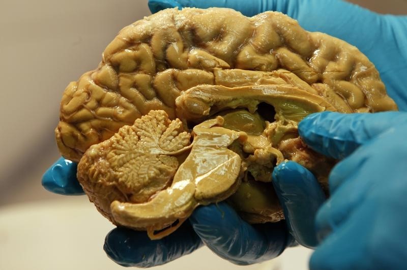 © Reuters. Tamas Freund holds a human brain at the Institute of Experimental Medicine of Hungarian Academy of Science in Budapest