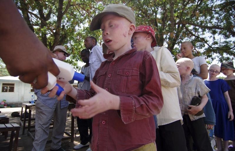 © Reuters. La ONU condena la persecución y asesinato de albinos en el este de África