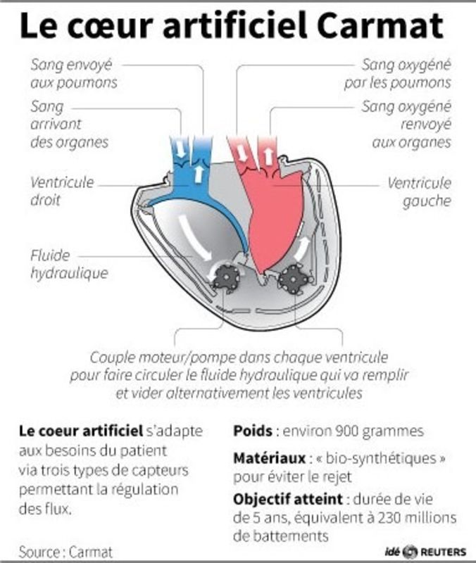 © Reuters. LE COEUR ARTIFICIEL CARMAT