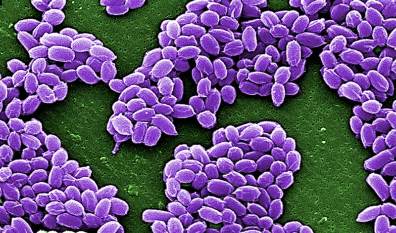 © Reuters. Esporos de cepa Sterne de antraz ("Bacillus anthracis") em imagem obtida pela Reuters