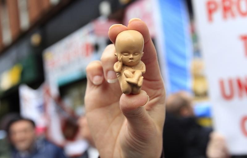 © Reuters. A pro-life campaigner holds up a model of a 12-week-old embryo during a  protest outside the Marie Stopes clinic in Belfast