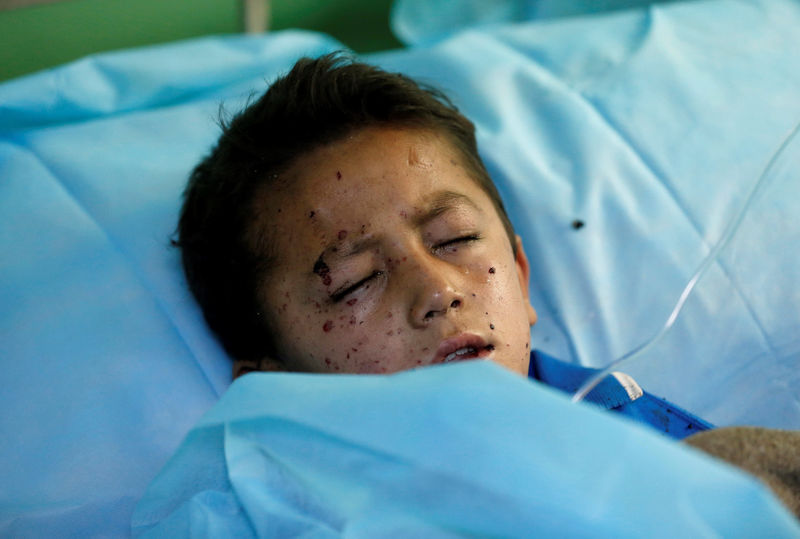 © Reuters. An injured boy receives treatment at a hospital after a suicide attack in Kabul, Afghanistan