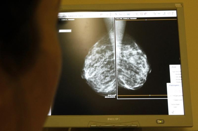 © Reuters. A woman undergoes a mammograms, a special type of X-ray of the breasts, which is used to detect tumours as part of a regular cancer prevention medical check-up at a clinic in Nice