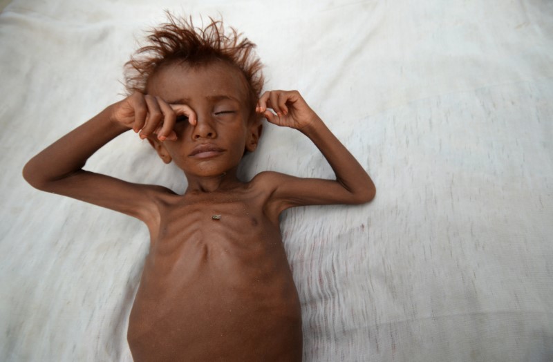 © Reuters. The Wider Image: Risk of famine looms in Yemen