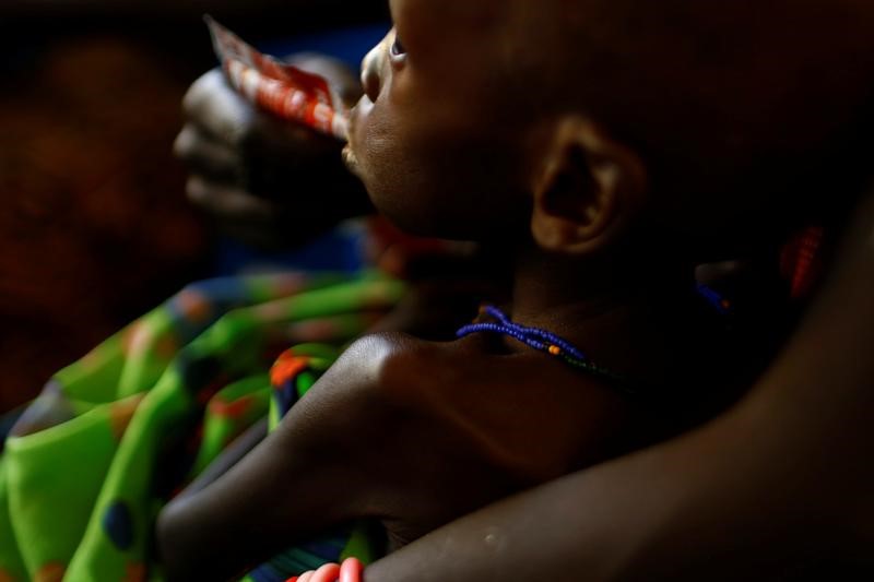 © Reuters. La ONU dice que hay 1,4 millones de niños en riesgo inminente de morir de hambre