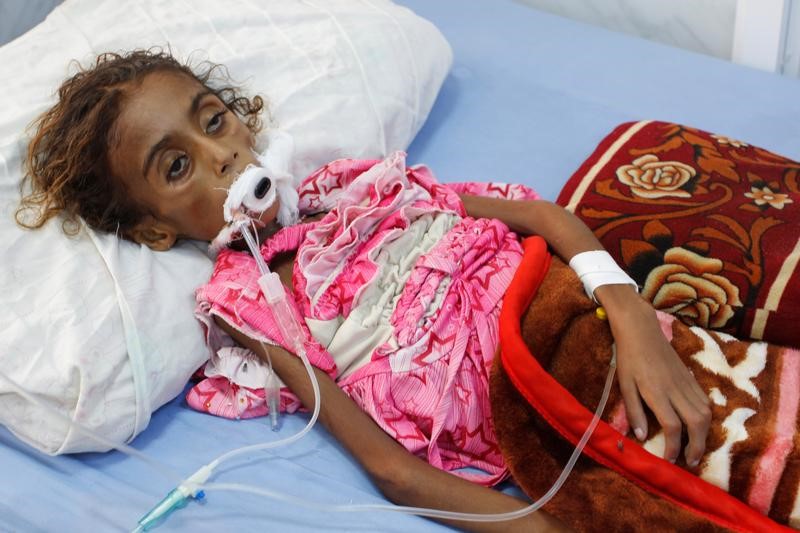 © Reuters. ضحية جديدة لحرب اليمن .. موت جميلة ابنة السبعة أعوام