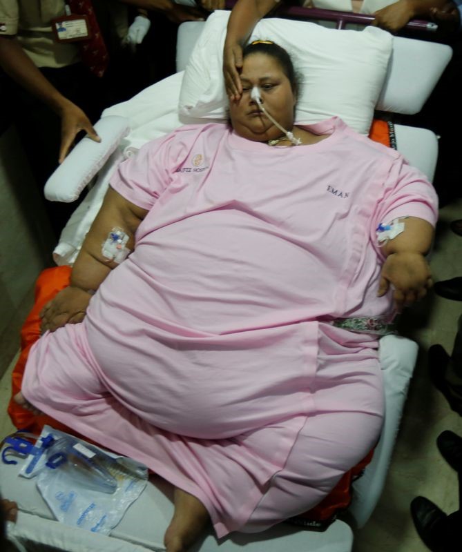 © Reuters. مصرية تغادر مستشفى بالهند بعد أن فقدت 300 كيلوجرام من وزنها