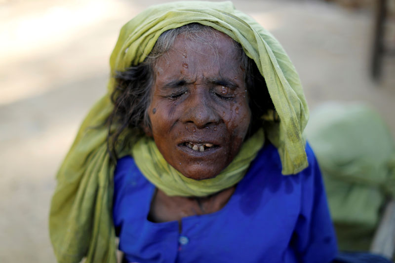 © Reuters. Refugiada rohingya durante checagem médica em Palang Khali, Bangladesh