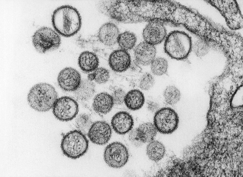 © Reuters. A transmission electron micrograph (TEM) reveals the ultrastructural appearance of a number of virus particles, or “virions”, of a hantavirus known as the Sin Nombre virus