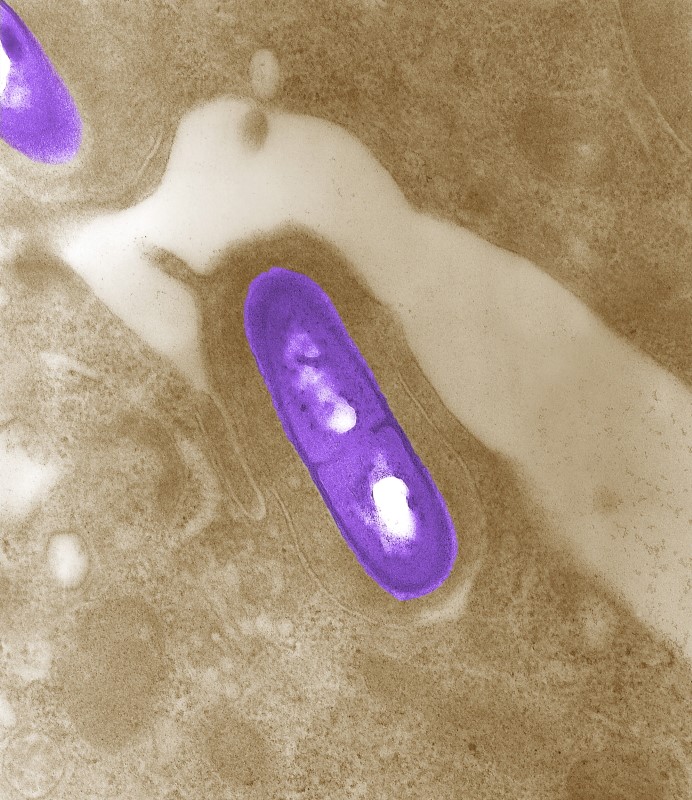 © Reuters. Handout image of electron micrograph of a Listeria bacterium in tissue