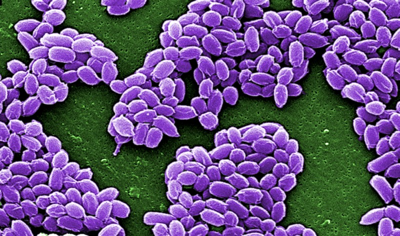 © Reuters. Spores from the Sterne strain of anthrax bacteria (Bacillus anthracis) are pictured in this handout scanning electron micrograph