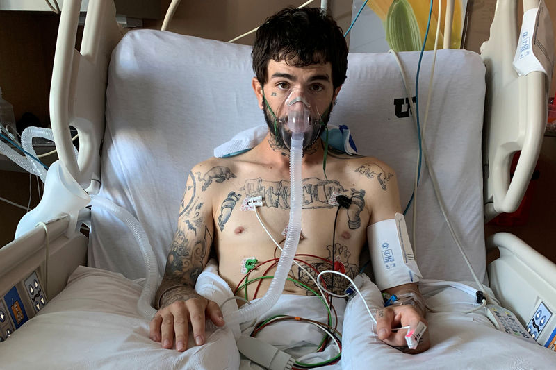 © Reuters. Jeffrey Manzanares lies in the intensive care unit of the University of Utah Hospital