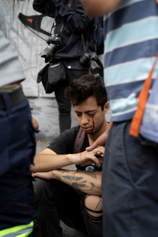 Cegado por balas de borracha, estudante chileno se torna símbolo de protestos