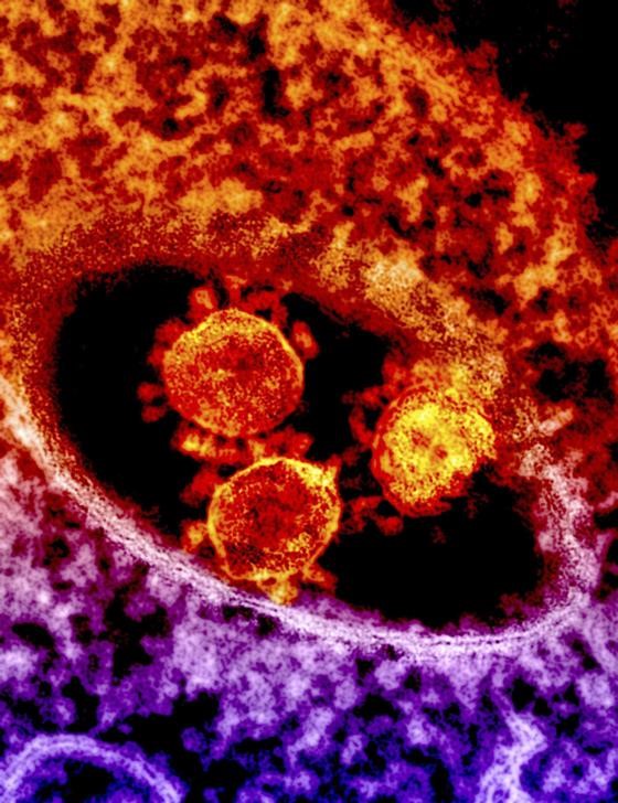 Tailandia detecta segundo caso de nuevo coronavirus surgido en China