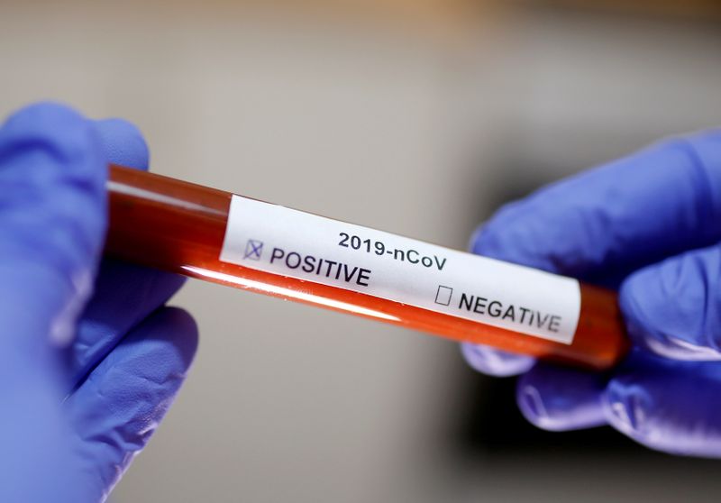 © Reuters. FILE PHOTO: Test tube with Corona virus name label is seen in this illustration picture