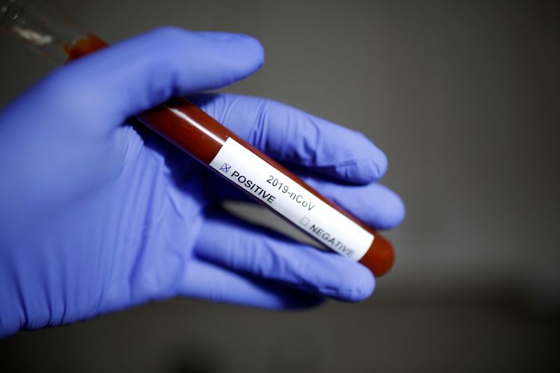 © Reuters. FILE PHOTO: Test tube with Corona virus name label is seen in this illustration picture