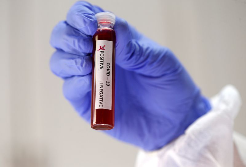 © Reuters. Fake blood is seen in test tubes labelled with the coronavirus (COVID-19) in this illustration