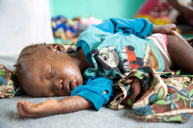 &copy; Reuters. Dobo Mbanza, de tres años de edad, yace en una cama en la sala de aislamiento del hospital Boso-Manzi