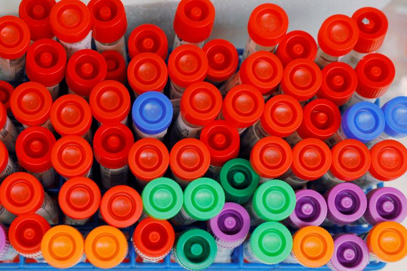 &copy; Reuters. FOTO DE ARCHIVO: Los muestras para las pruebas del coronavirus (COVID-19) se registran para ser procesadas en el laboratorio de Virología Médica de la UW en Seattle