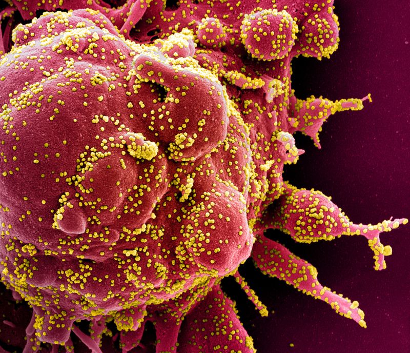 © Reuters. Colorized scanning electron micrograph of apoptotic cell infected with novel coronavirus