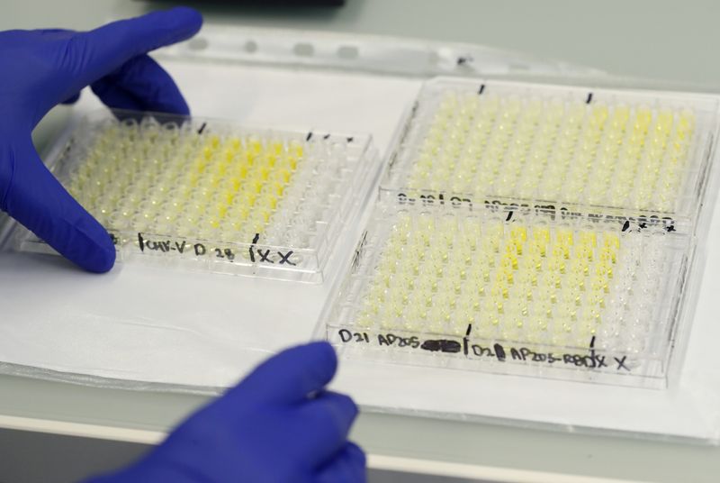 © Reuters. Amostras de exames para coronavírus em laboratório em Berna, na Suíça