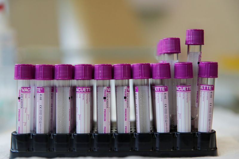 &copy; Reuters. Пробирки в клинике Hadassah, предлагающей тесты на антитела к коронавирусу, в Москве
