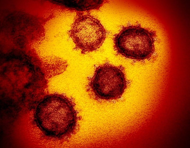 &copy; Reuters. Transmission electron microscope image shows SARS-CoV-2, also known as novel coronavirus