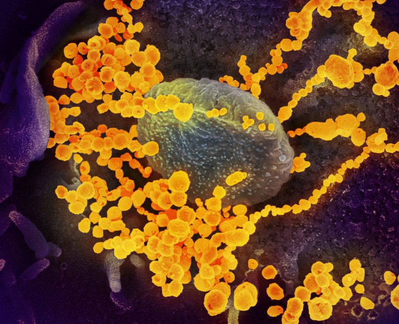 &copy; Reuters. Una imagen sin fecha del microscopio electrónico de barrido muestra el SARS-CoV-2 (objetos dorados redondos), emergiendo de la superficie de las células cultivadas en el laboratorio