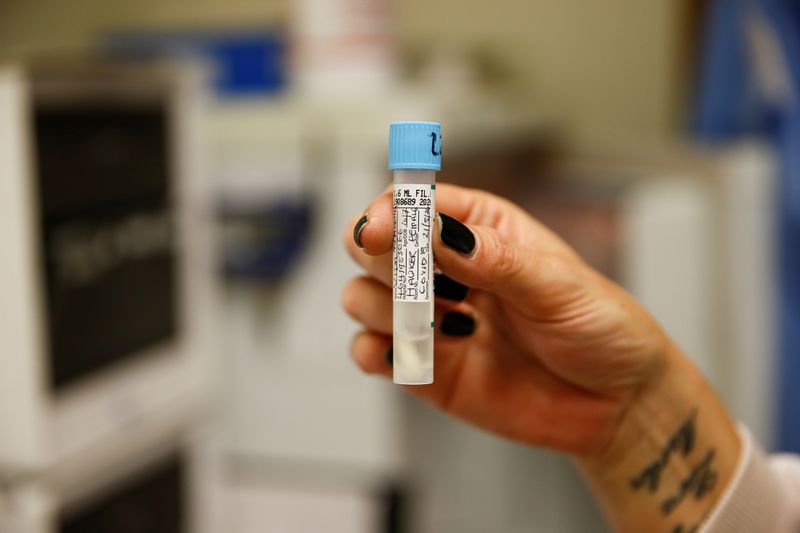 © Reuters. A medical worker tests swabs for the novel coronavirus at the Microbiology department of North Devon District Hospital in Barnstaple