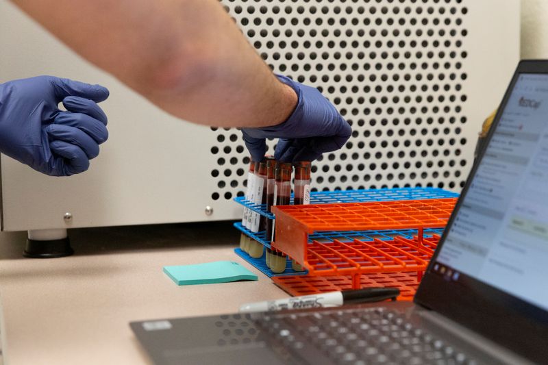 &copy; Reuters. Foto ilustrativa del viernes de un investigador de la Universidad de Arizona preparando unas muestras de sangre para un estudio de anticuerpos al coronavirus