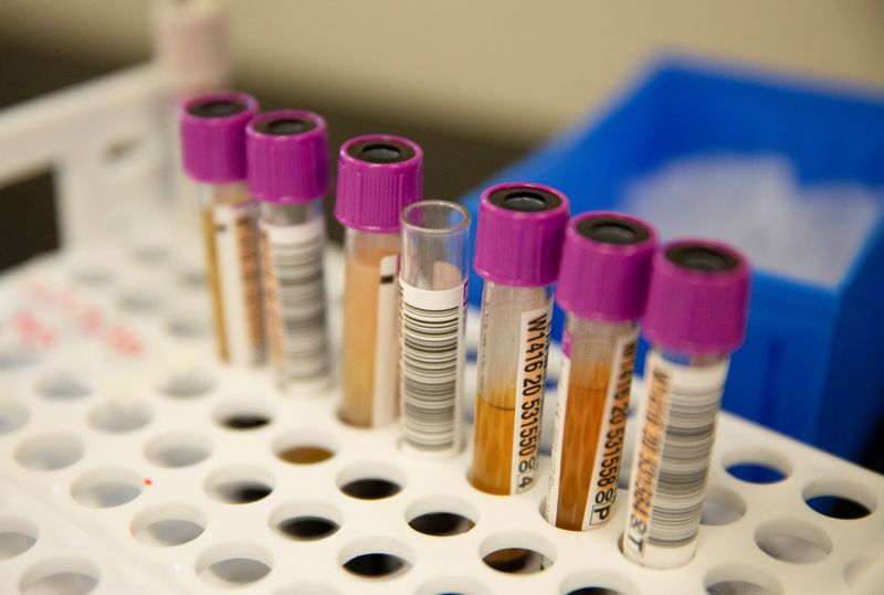 © Reuters. Plasma samples at Bloodworks in Renton