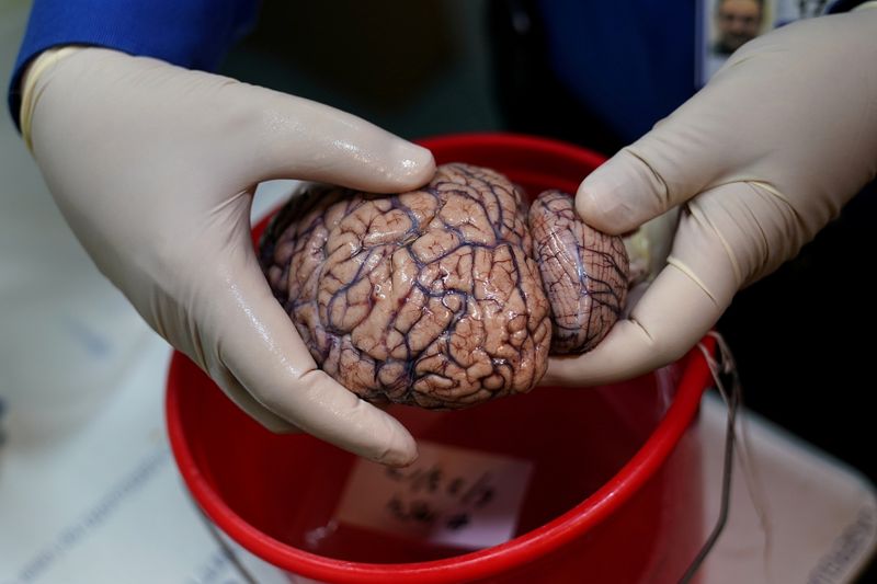 &copy; Reuters. FILE PHOTO: Dr. Vahram Haroutunian holds a human brain in a brain bank in the Bronx borough of New York City