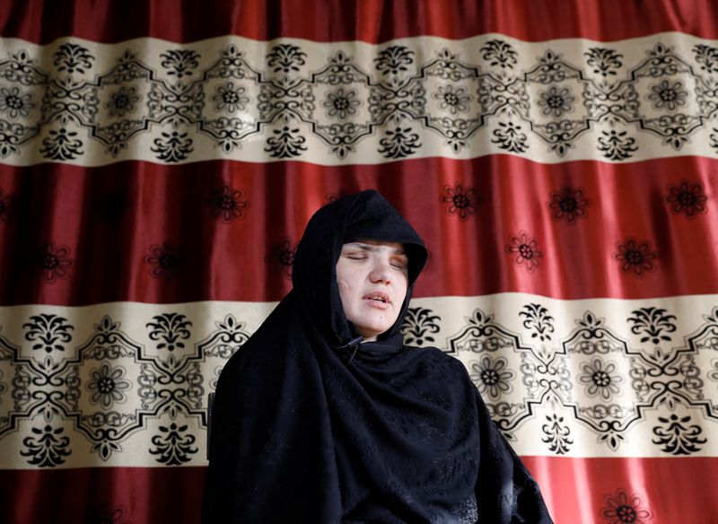 &copy; Reuters. Afghan police woman who was blinded after gunmen attack interviewed in Kabul