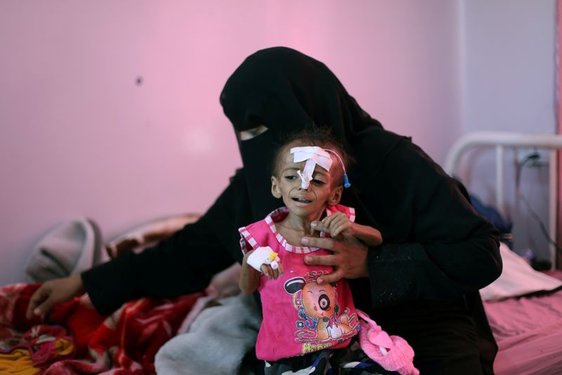 &copy; Reuters. &quot;عد تنازلي لكارثة&quot; في اليمن والأمم المتحدة تحذر من المجاعة مجددا