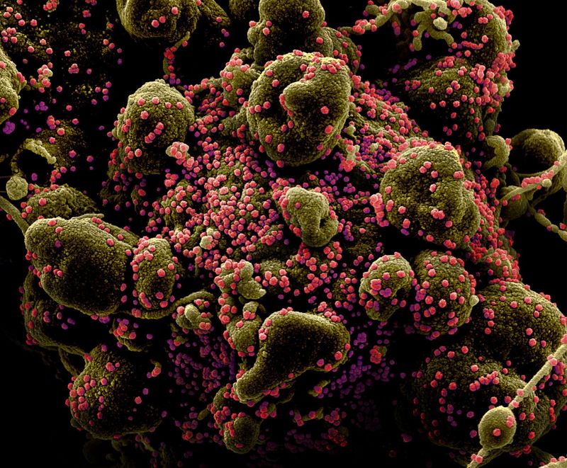 © Reuters. FILE PHOTO: Colorized scanning electron micrograph of an apoptotic cell heavily infected with SARS-COV-2 virus particles, also known as novel coronavirus