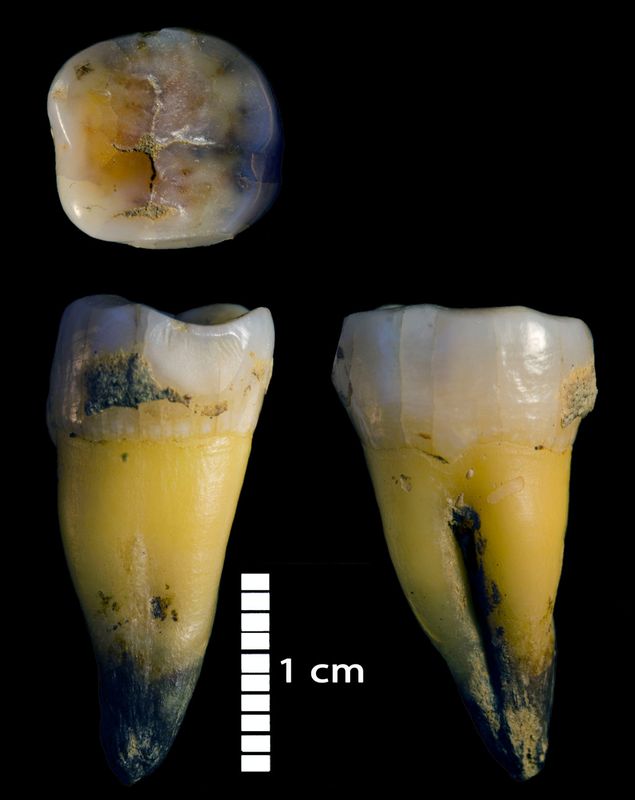 © Reuters. A molar of a male Homo sapiens individual who lived approximately 45,000-year-old