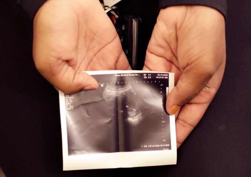 &copy; Reuters. FILE PHOTO: A patient from Texas holds a sonogram that she received at the Hope Medical Group for Women in Shreveport