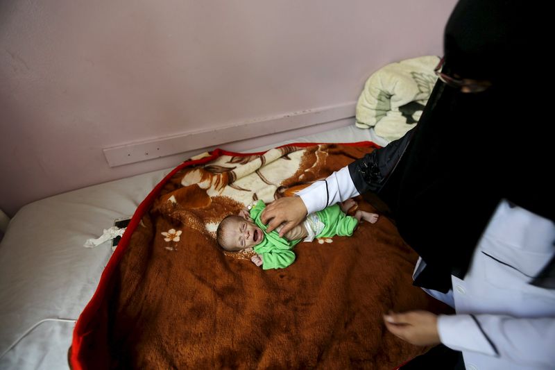 © Reuters. سوء التغذية يهدد أرواح الصغار في مستشفى باليمن