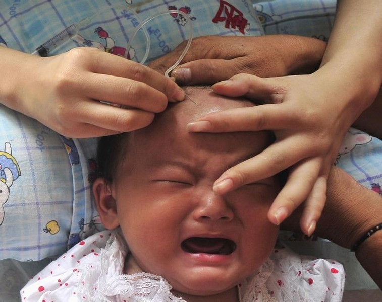 © Reuters. Muchos bebés sufren dolor innecesario en los ensayos clínicos