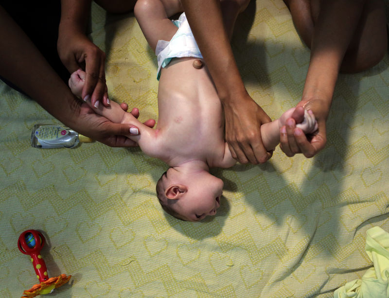 © Reuters. Bebê com microcefalia é tratado em Recife 