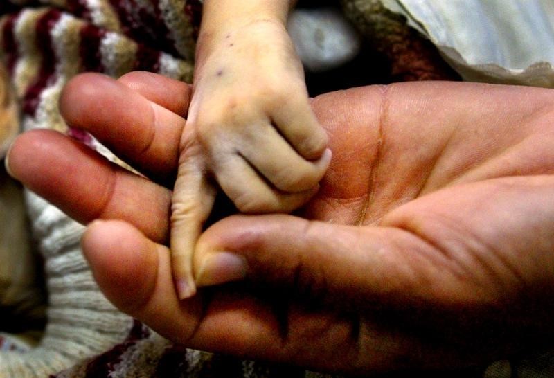 © Reuters. Leucemia de un segundo bebé remite tras tratamiento con células "de diseño"