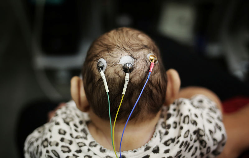 © Reuters. Bebê com microcefalia faz exames na Universidade de São Paulo 