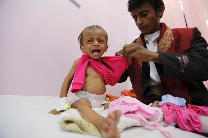 © Reuters. الأمم المتحدة تقول جمعت 16% من مناشدتها لتقديم مساعدات إنسانية لليمن