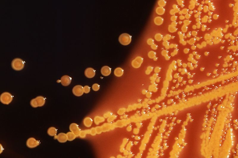 © Reuters. Colonies of E. coli bacteria are seen in a microscopic image courtesy of the CDC
