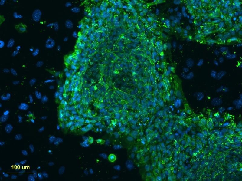 © Reuters. الخلايا الجذعية تظهر نتائج مبشرة في علاج الإكزيما المتوسطة والحادة