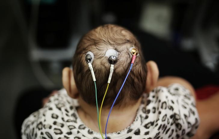 © Reuters. Bebê de 5 meses com microcefalia passa por exames em São Paulo