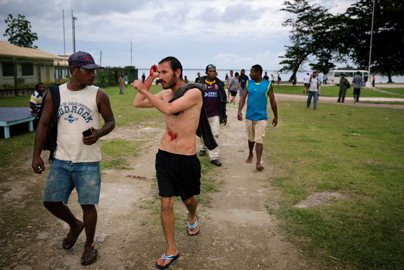 © Reuters. An injured refugee from the Australian-funded Manus Island detention centre is pictured in Lorengau after an alleged attack by a group of Papua New Guinean men